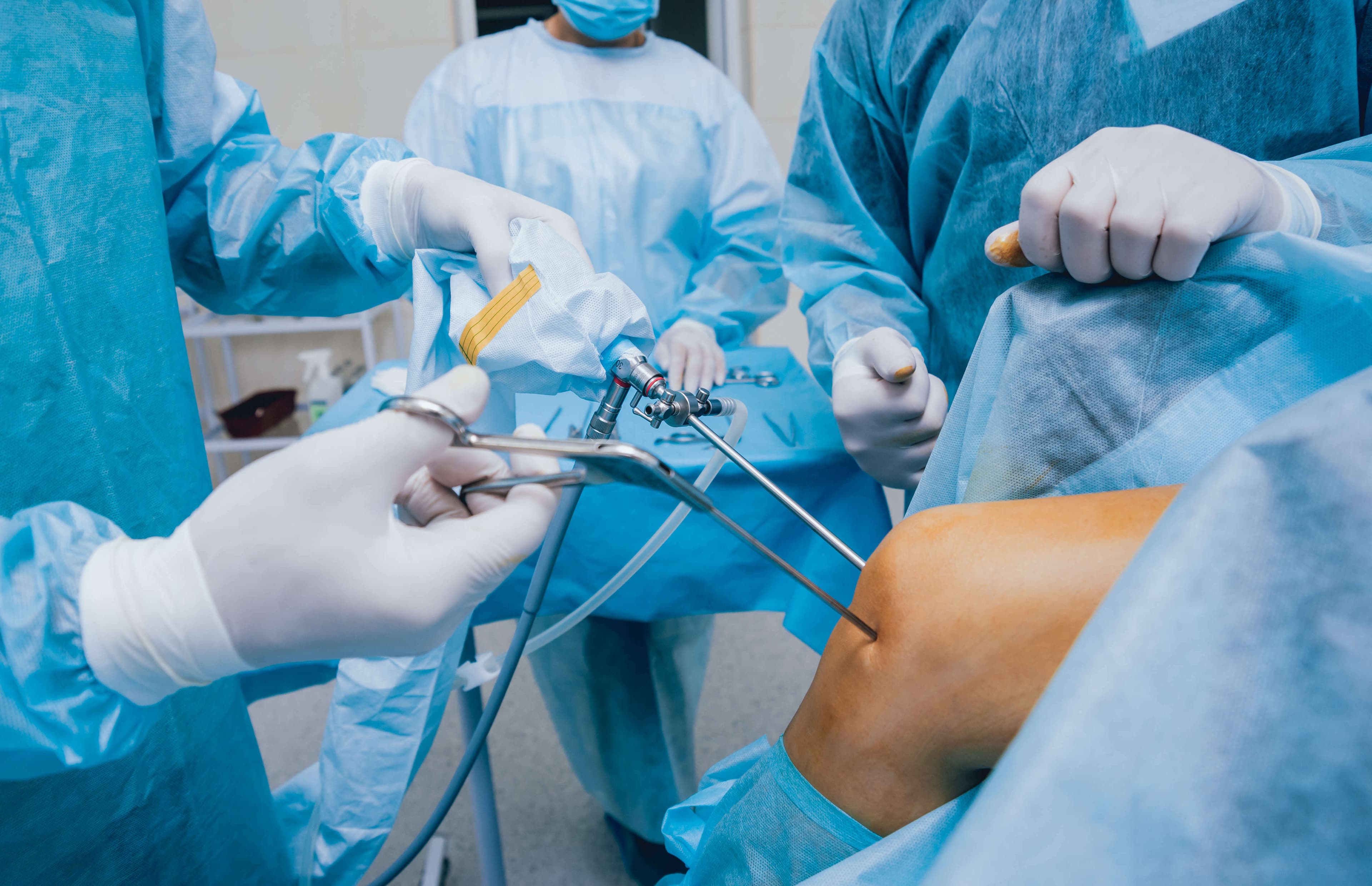 Vue arthroscopique per-opératoire d'une méniscectomie
